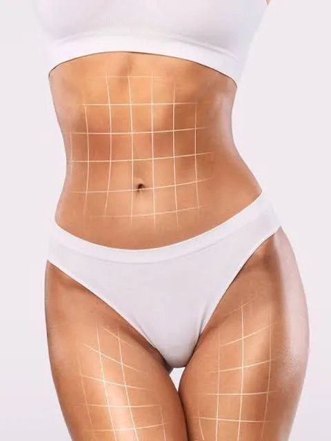 Body contouring result illustration at Hollywood Clinic