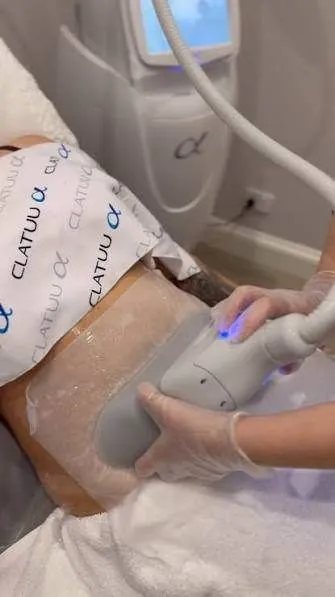 Clatuu Alpha applicator treating the abdomen