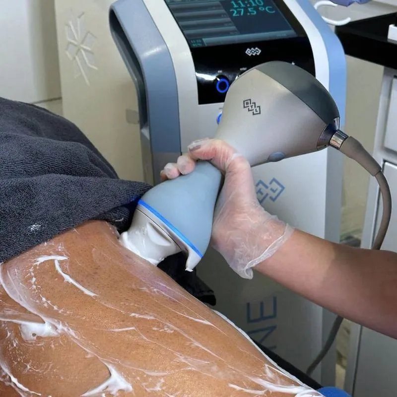 EMTONE applicator treating the thigh