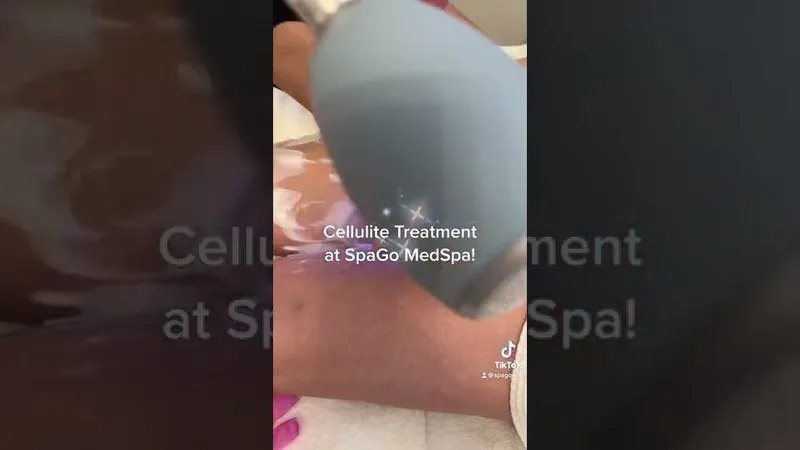 EMTONE — radiofrequency and pressure waves in action