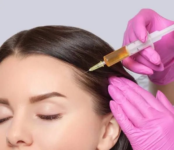 Exosome treatment on the crown for thicker hair