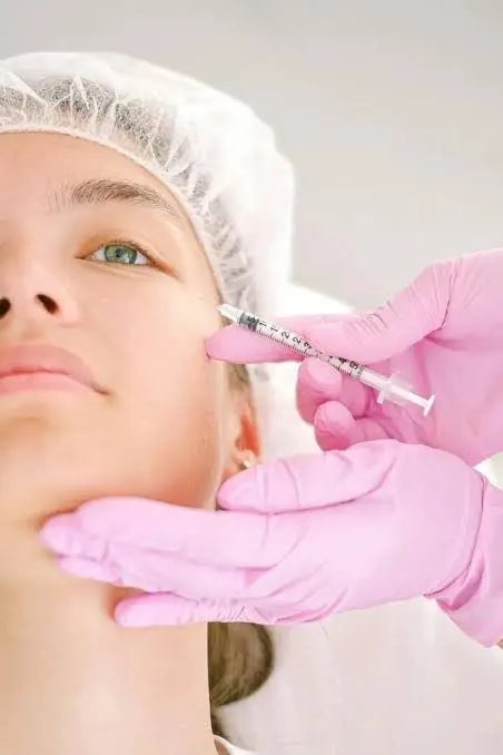 Lip enhancement with dermal filler