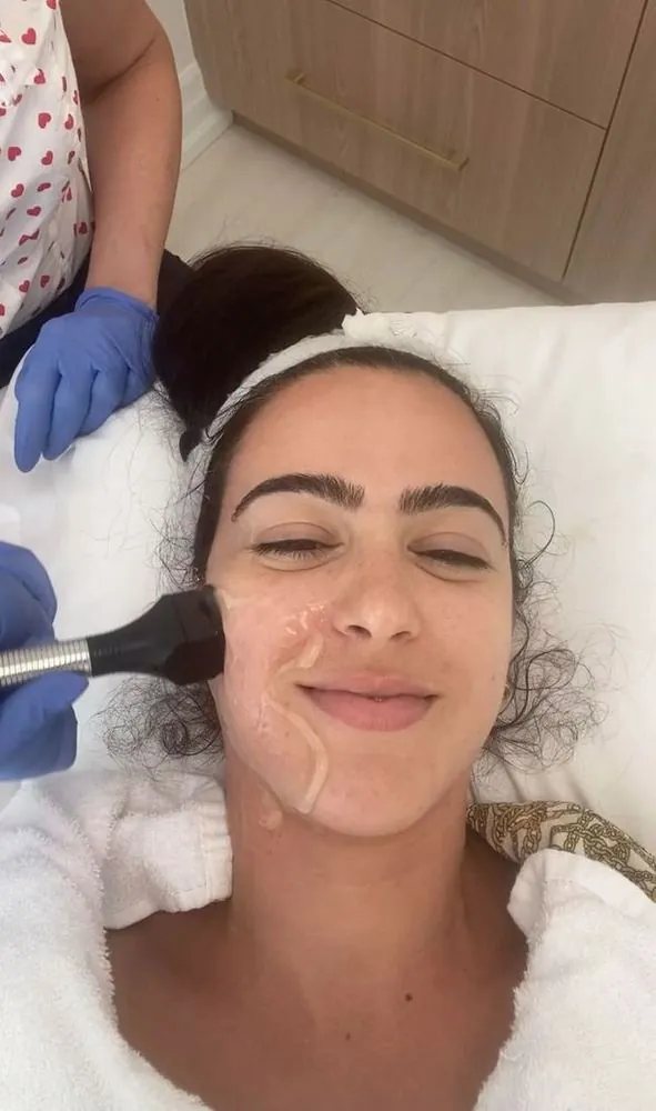 Facial contour and lifting direction map