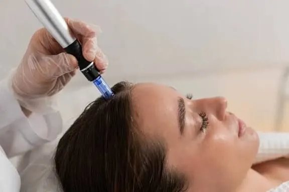Growth factor hair restoration treatment