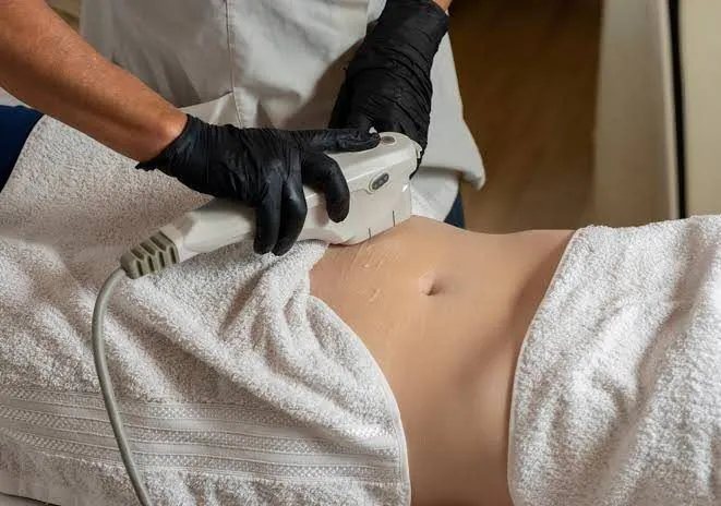 HIFU Body applicator treating the abdomen
