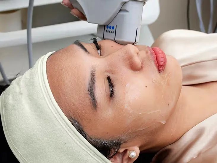 HIFU applicator treating the face at Hollywood Clinic