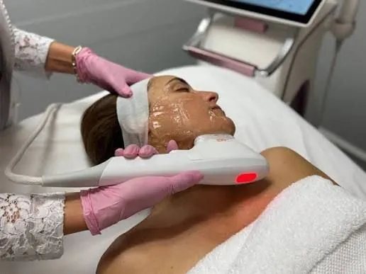 HIFU non-surgical face lift treatment