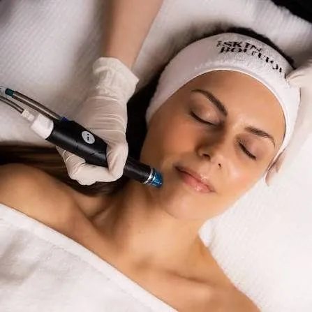 HydraFacial extraction step at Hollywood Clinic