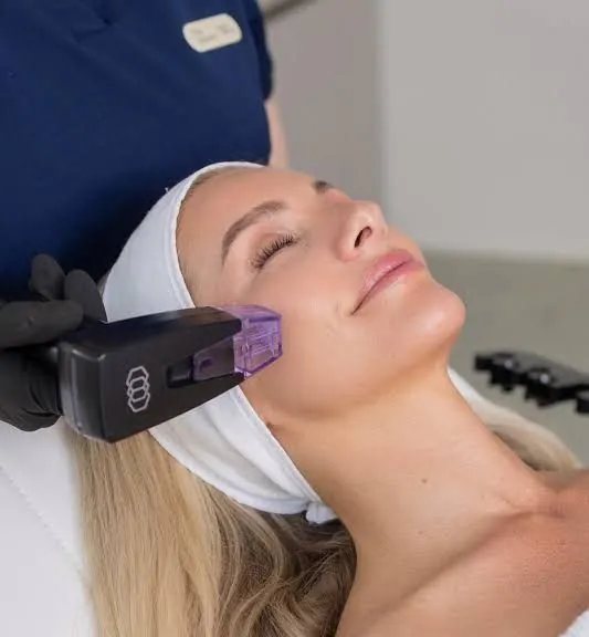 Morpheus8 microneedling treatment on the face at Hollywood Clinic