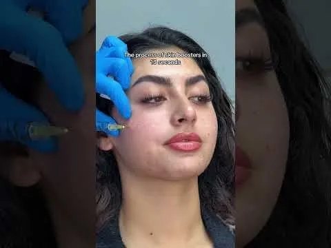 Skin booster treatment video at Hollywood Clinic