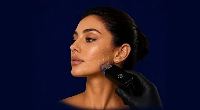 Morpheus8 RF microneedling at Hollywood Clinic